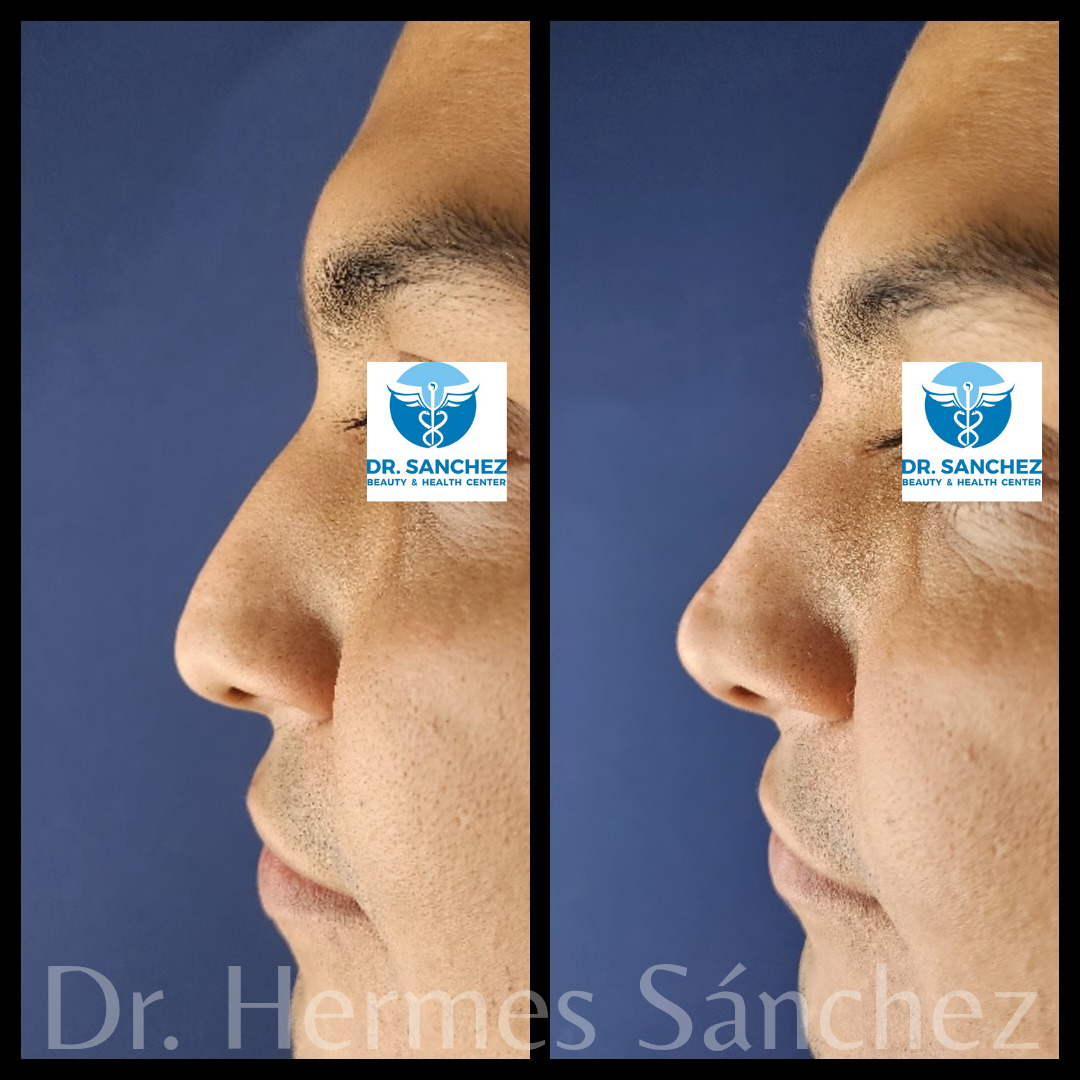 Galería - Transformación 7